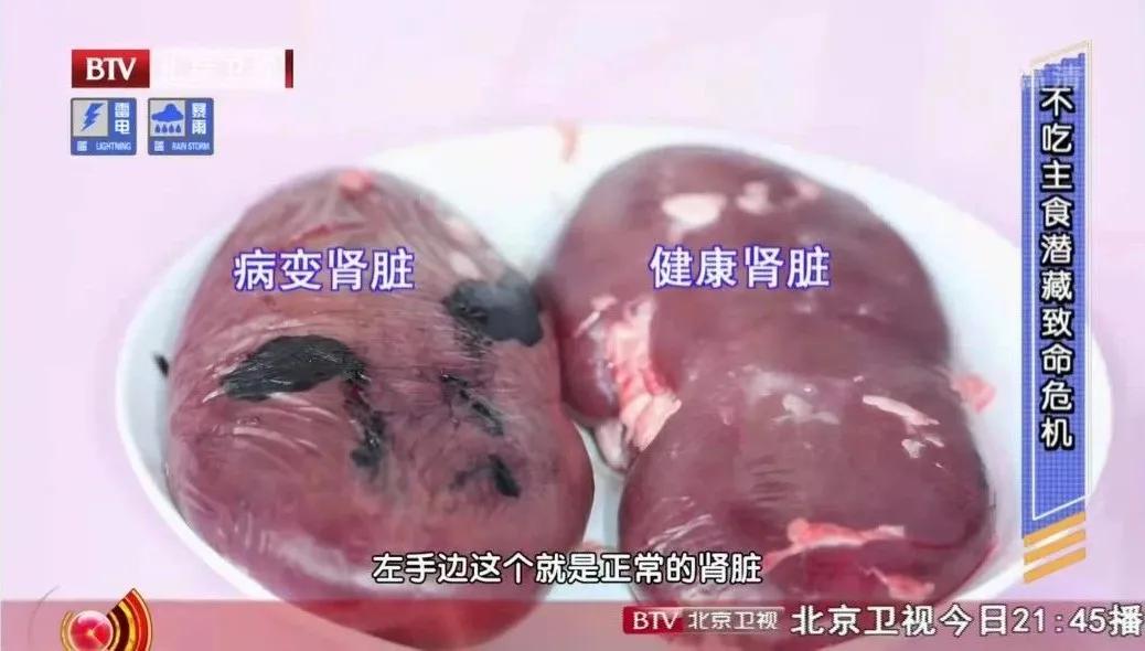 减肥食谱营养搭配_营养减肥食谱三餐_减肥食谱营养餐